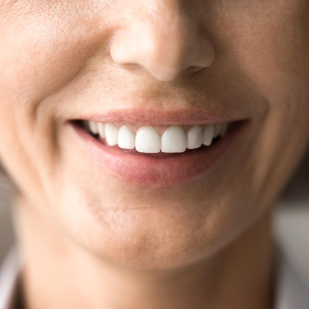 Ballıpınar Gülüş Tasarımı