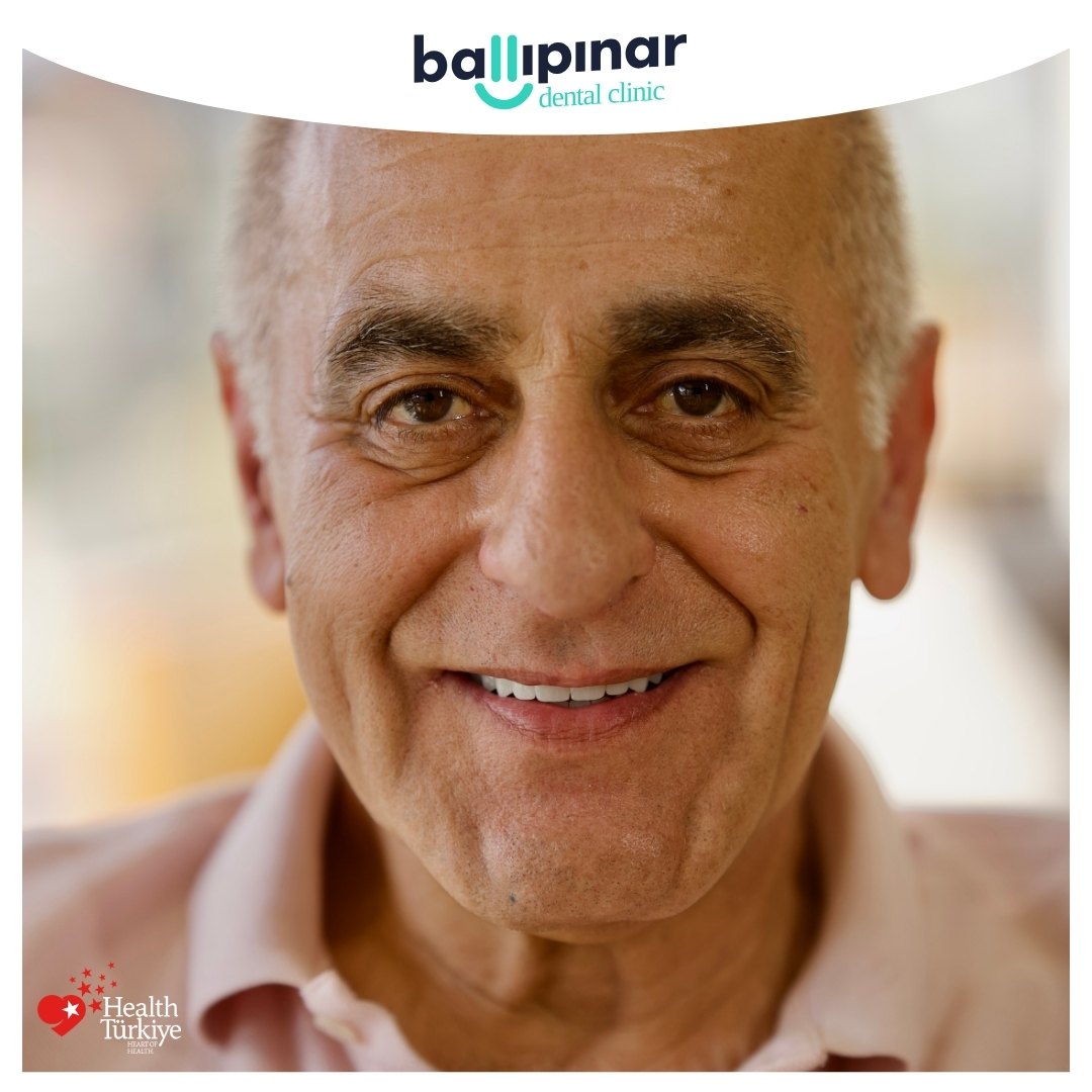 All on Six Implants Tedavi Süreci ve Fiyatları