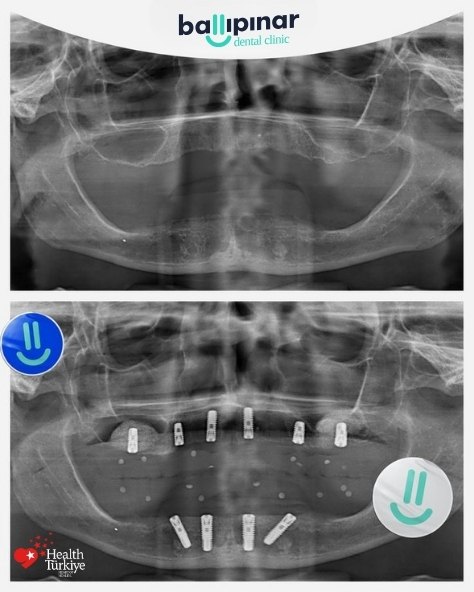 treatment-content-image-2