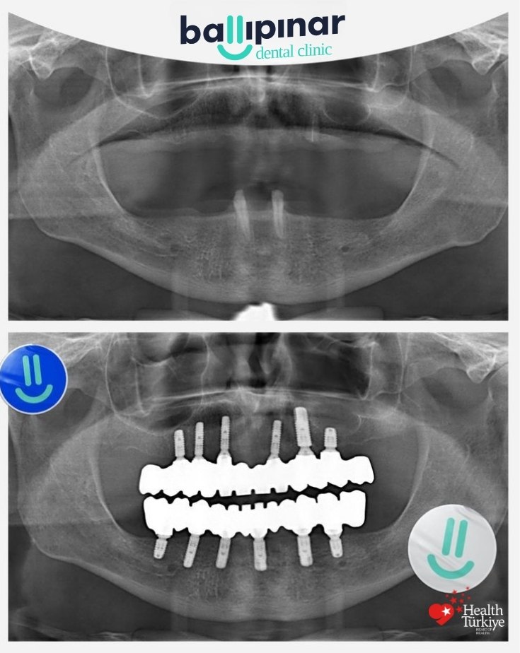 treatment-content-image-2