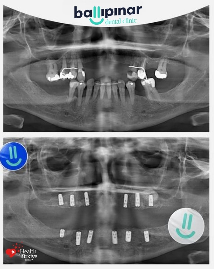 treatment-content-image-1