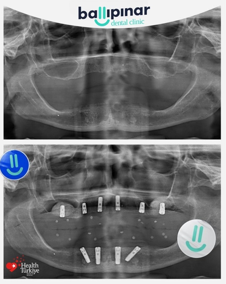 treatment-content-image-2